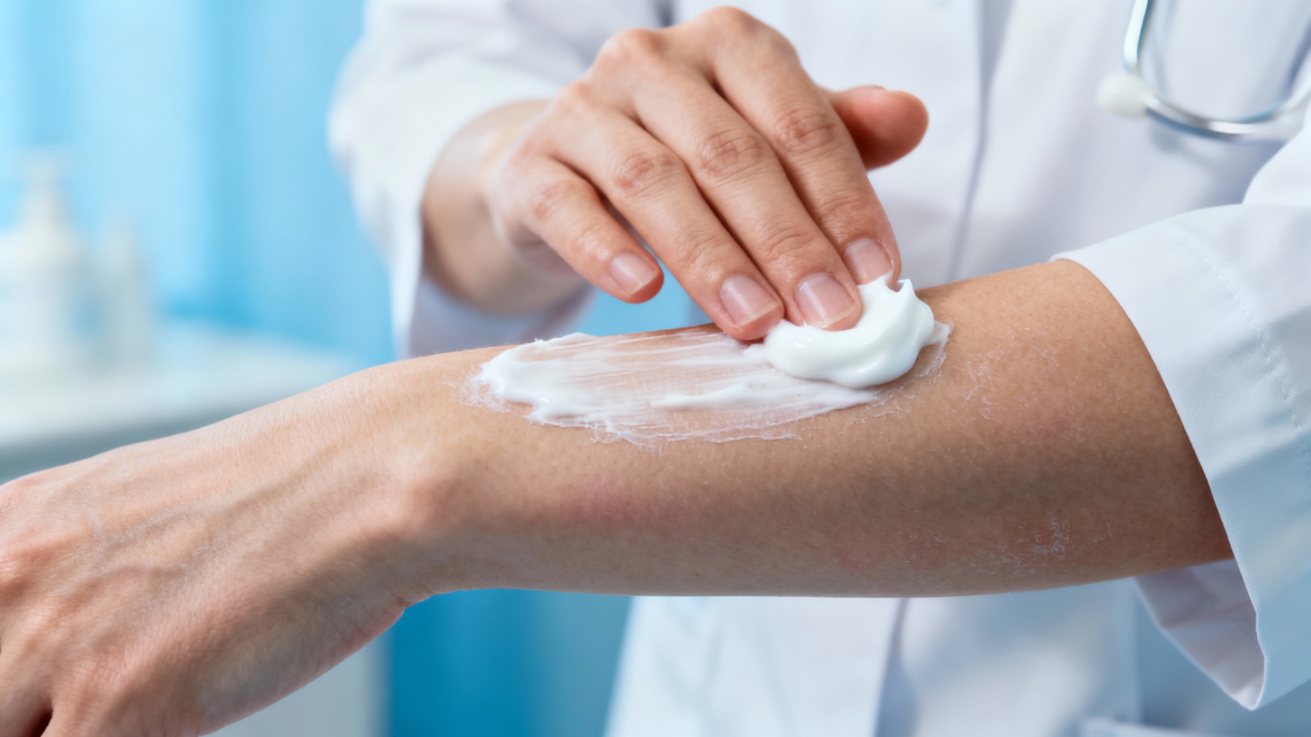 Featured image for Unleash Relief: Expert Strategies for Eczema Flare-Up Management